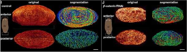 Segmentation of anterior and posterior muscle fibers in the control and in in β-catenin-1 RNAi planarian