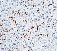 Potentiated CD16 activated ADCC CAR-NK cells