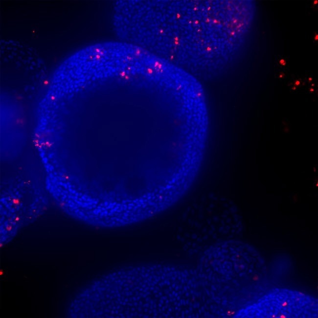 Scalable ImageXpress Confocal HT.ai High-Content Imaging System