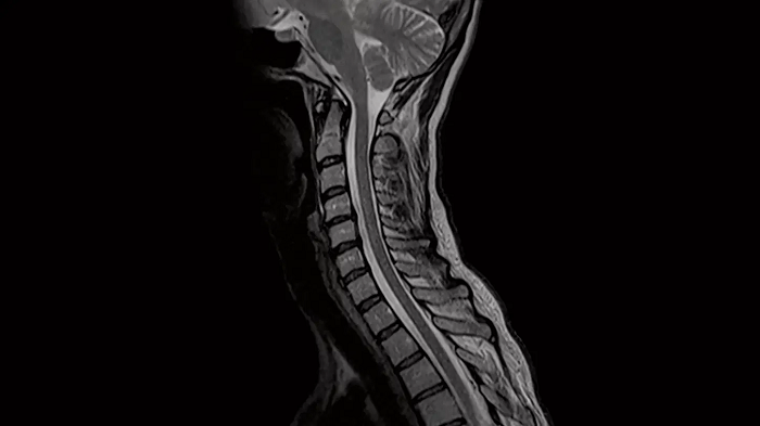 80 cm bore MAGNETOM Free.Max