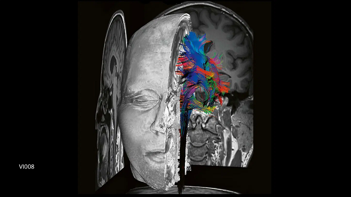 3T MRI scanner MAGNETOM Vida