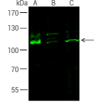 SCF/c-Kit signaling axis: Regulating cancer stemness