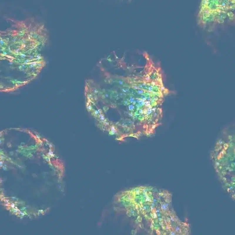 Drug-induced liver injury (DILI) in vitro services to predict human hepatotoxicity