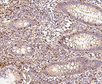 Immunochemical staining of human CD58 in human appendix.