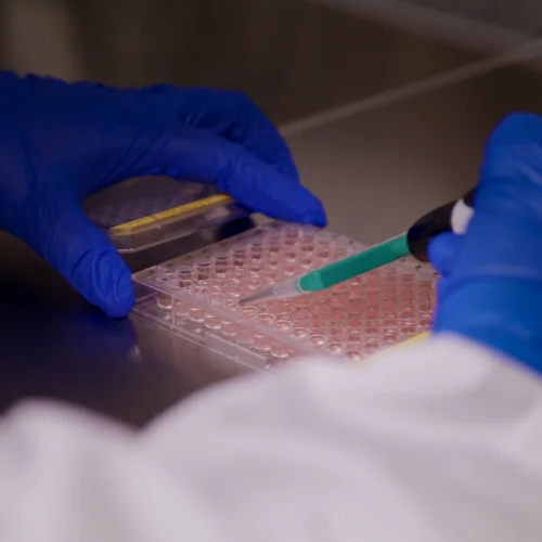 Retinal pigment epithelium for disease modeling