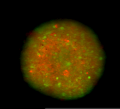 Spheroid Cytotoxicity