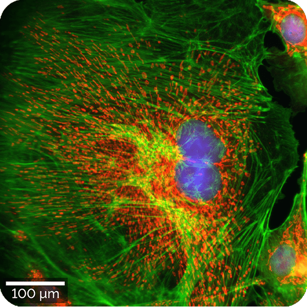 What makes the WITec360 Raman microscope the benchmark for correlative microscopy?