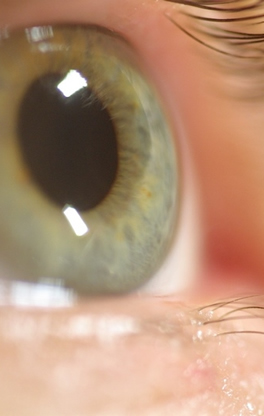 According to researchers from University College London, parts of the brain are temporarily