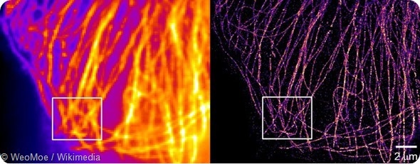 Super Resolution Microtubules BSC 1 cell.tif