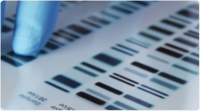 DNA sequencing