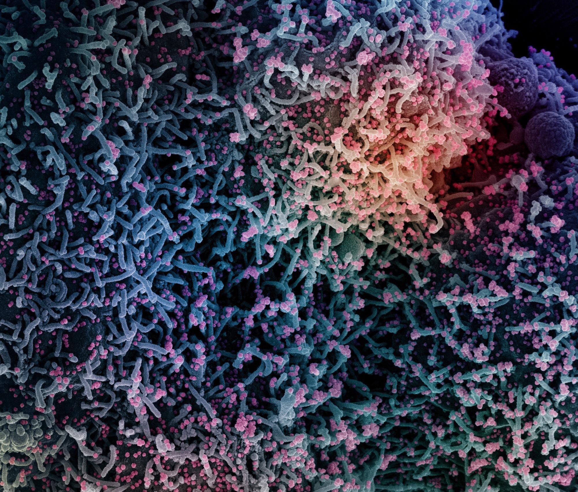 Study: Long-read RNA sequencing identifies polyadenylation elongation and differential transcript usage of host transcripts during SARS-CoV-2 in vitro infection. Image Credit: T-Rex Imagery / Shutterstock.com