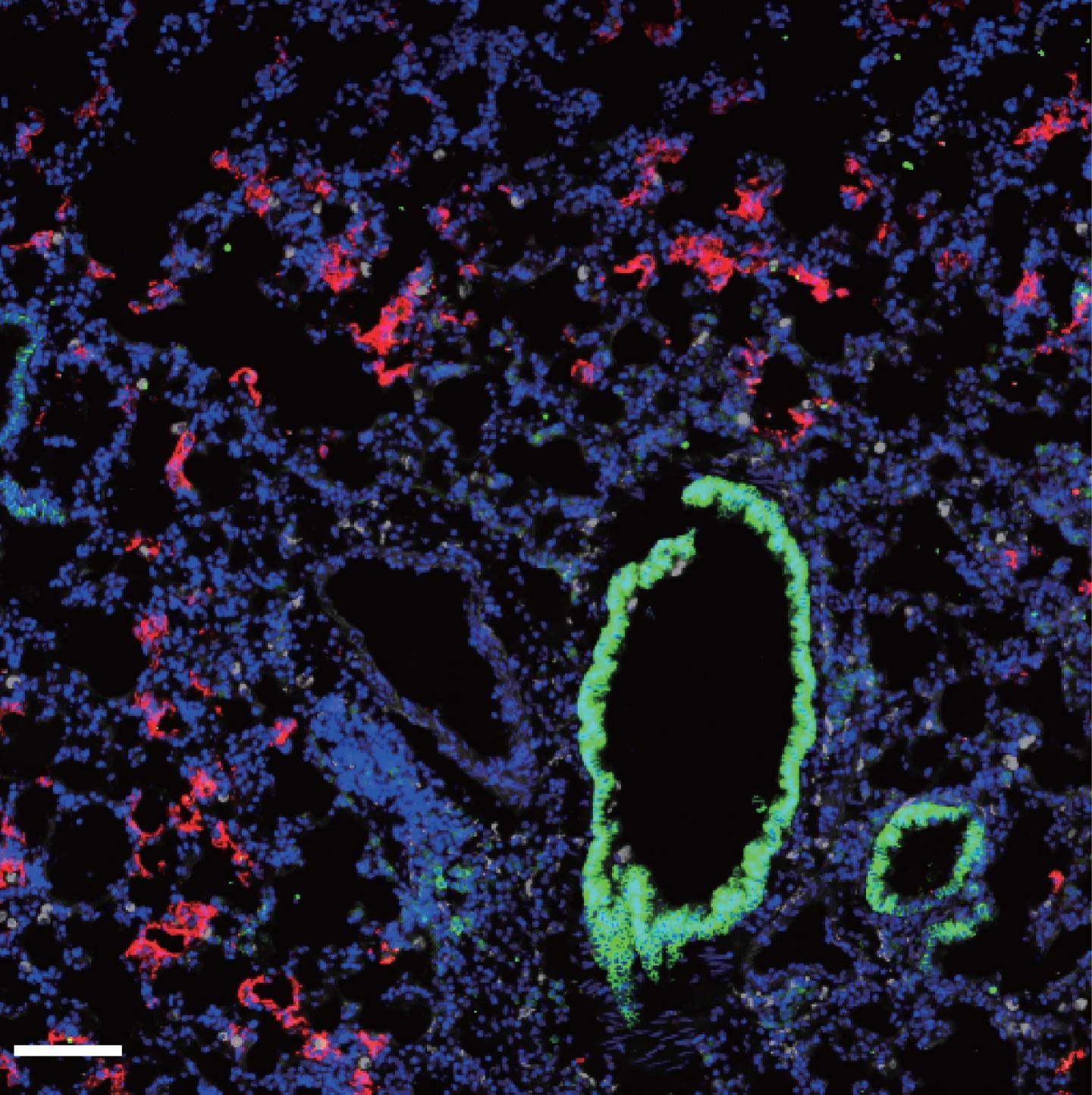 Fluorescence microscopy shows the presence of SARS-CoV-2 (red) within the lungs of mice expressing the human ACE2 protein. CREDIT © 2020 Israelow et al. Originally published in Journal of Experimental Medicine. https://doi.org/10.1084/jem.20201241