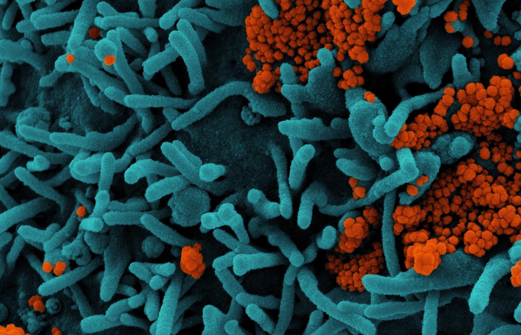 Study: UV and violet light can Neutralize SARS-CoV-2 Infectivity. Image Credit: NIAID