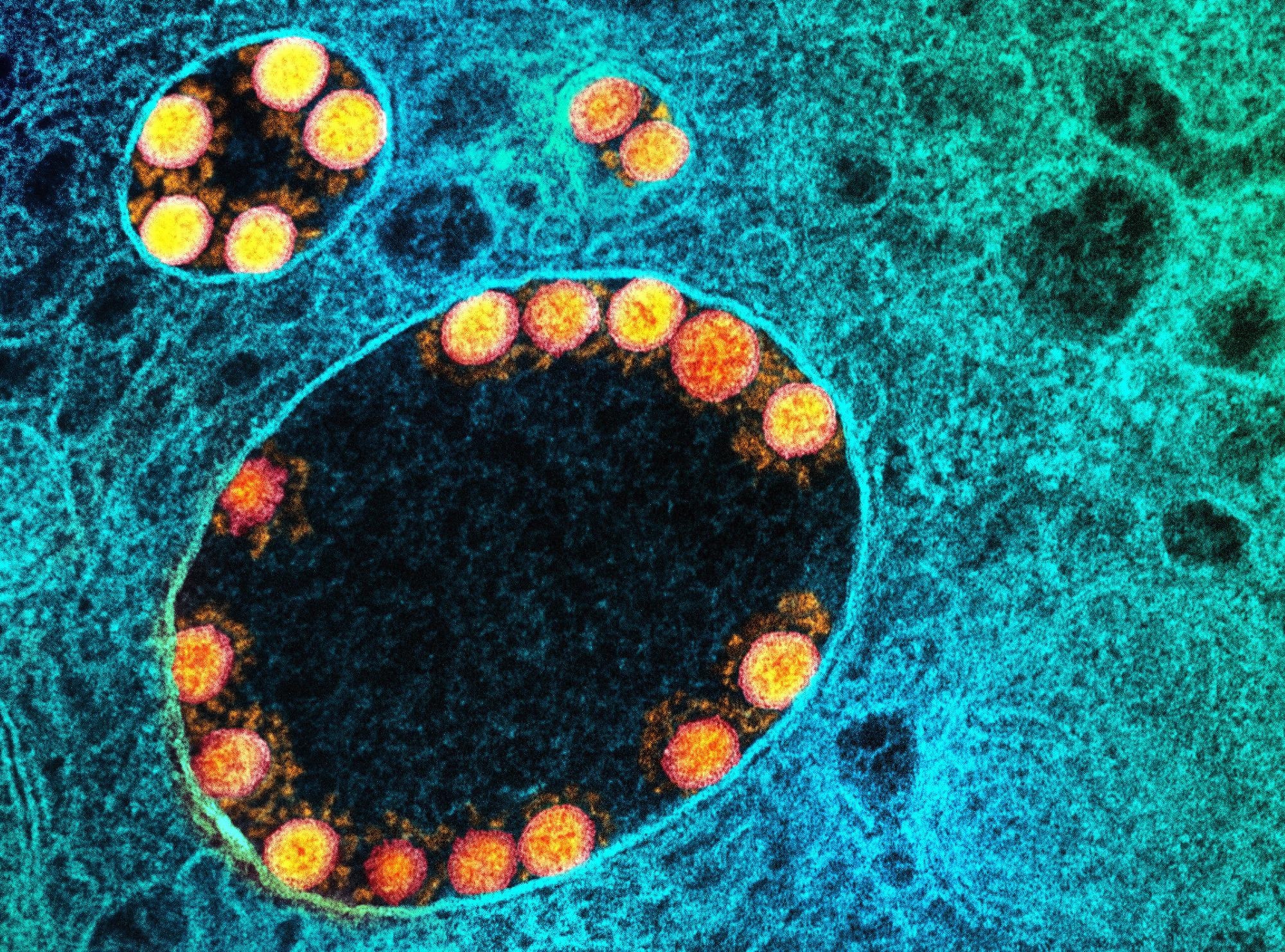 Study: Detection and Interspecies Comparison of SARS-CoV-2 Delta Variant (AY.3) in Feces from a Domestic Cat and Human Samples. Image Credit: NIAID
