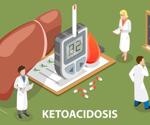 High prevalence of new-onset diabetes with ketoacidosis observed in children during COVID-19 pandemic