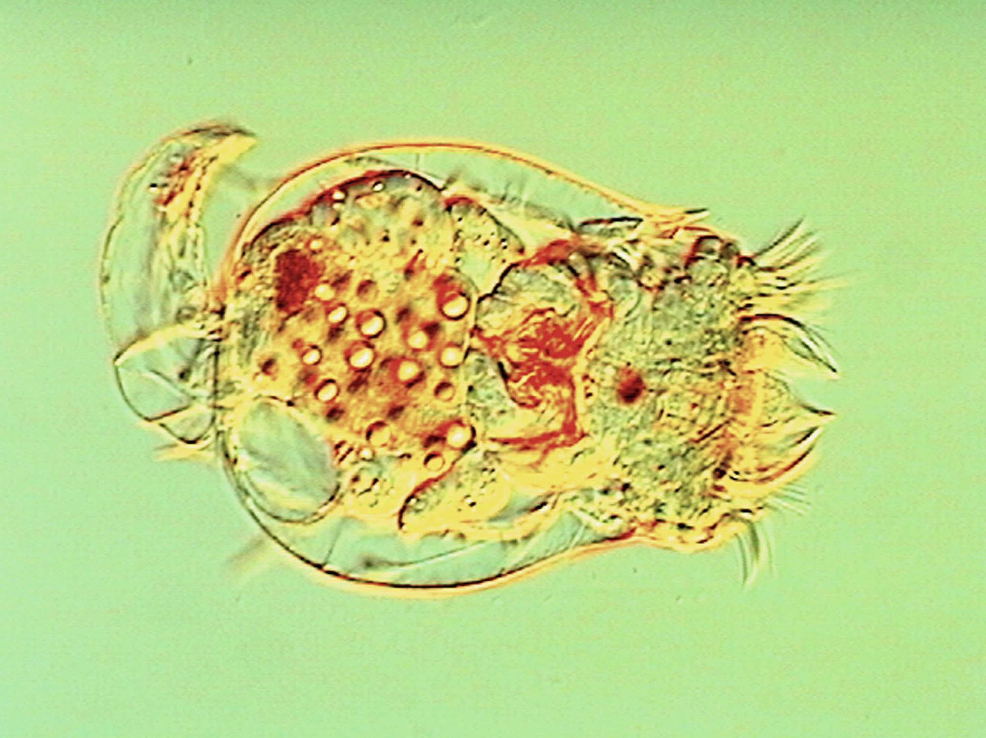 The rotifer Brachionus calyciflorus shown under Nomarski illumination, Robinson R (2007) In “Cryptic” Population Dynamics, Absence of Evidence Is Not Evidence of Absence. PLoS Biol 5(9): e255. doi:10.1371/journal.pbio.0050255