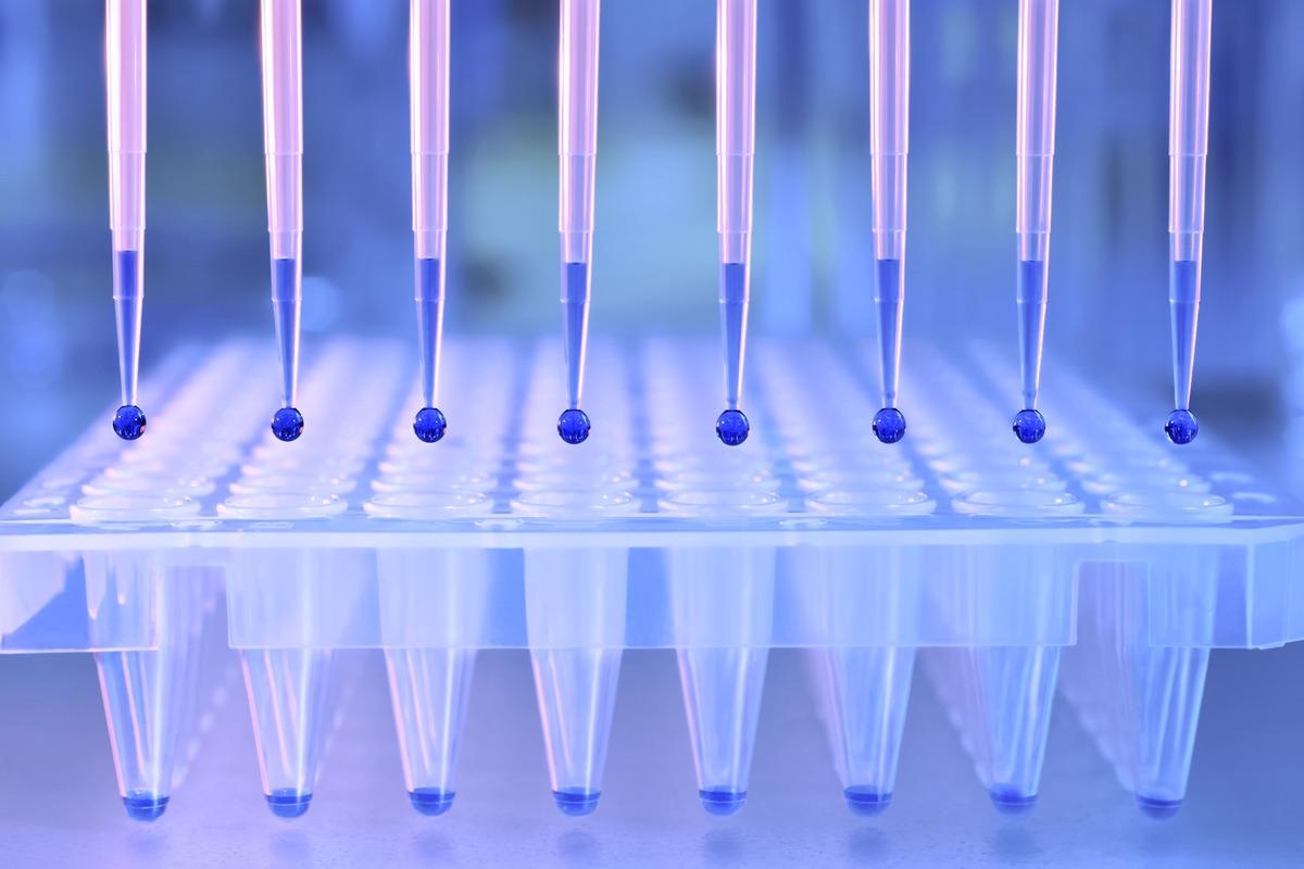 Study: RNAseq analysis reveals prominent and distinct expressed variants that are related to disease severity in SARS-CoV-2 infected patients with mild-to-severe disease. Image Credit: tilialucida/Shutterstock