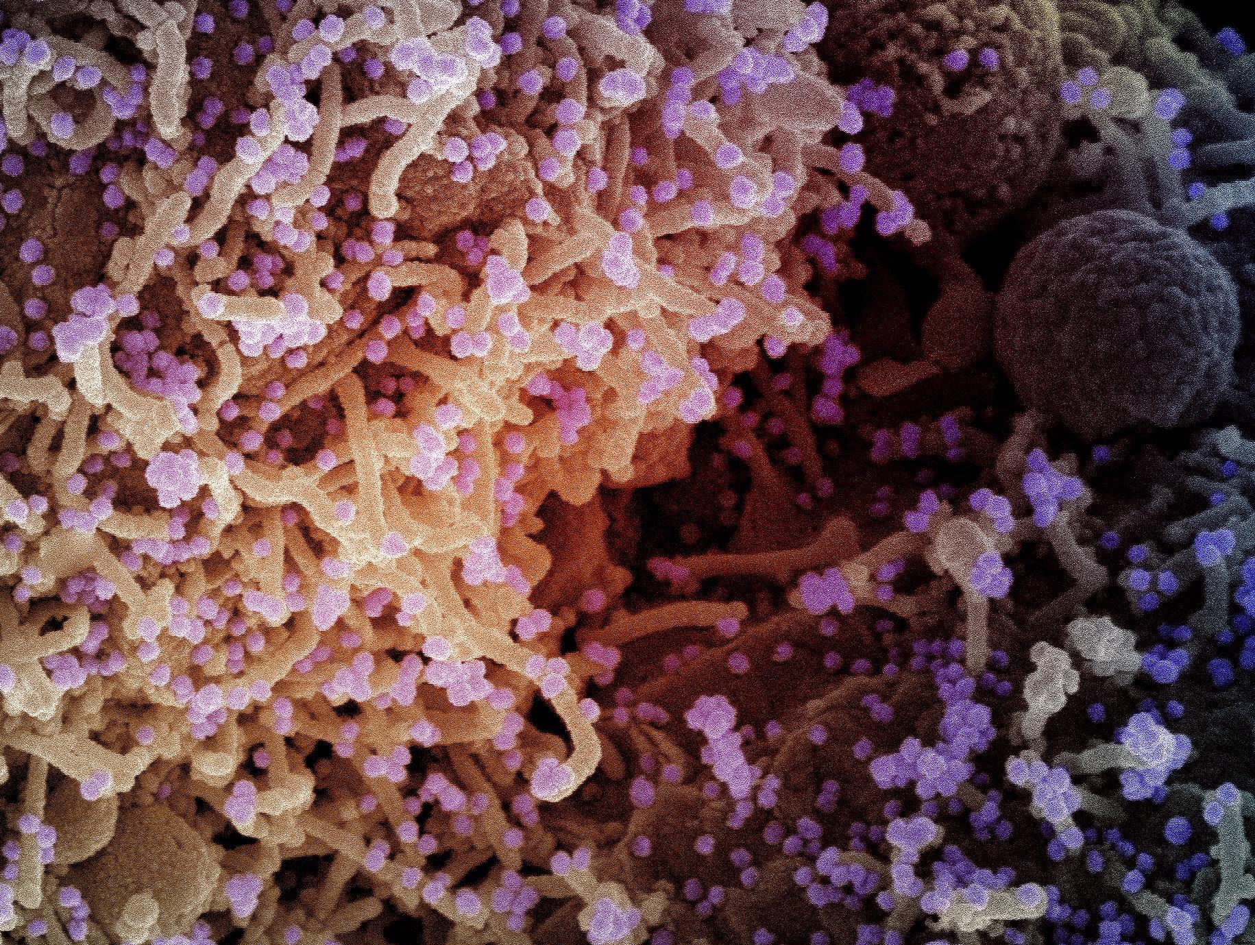 Study: Detection and prevalence of SARS-CoV-2 co-infections during the Omicron variant circulation, France, December 2021 - February 2022. Image Credit: NIAID