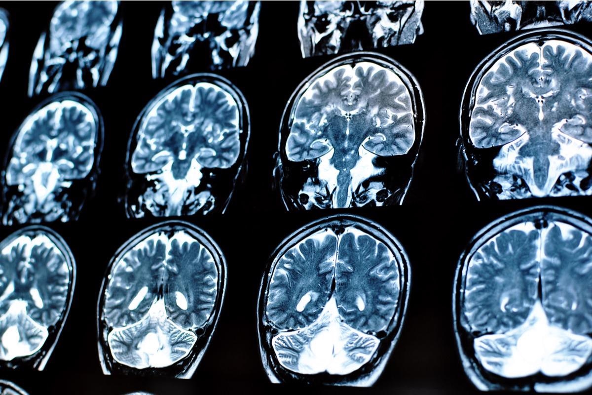 Study: Brain Charts for The Human Lifespan. Image Credit: Alina Bratosin / Shutterstock.com