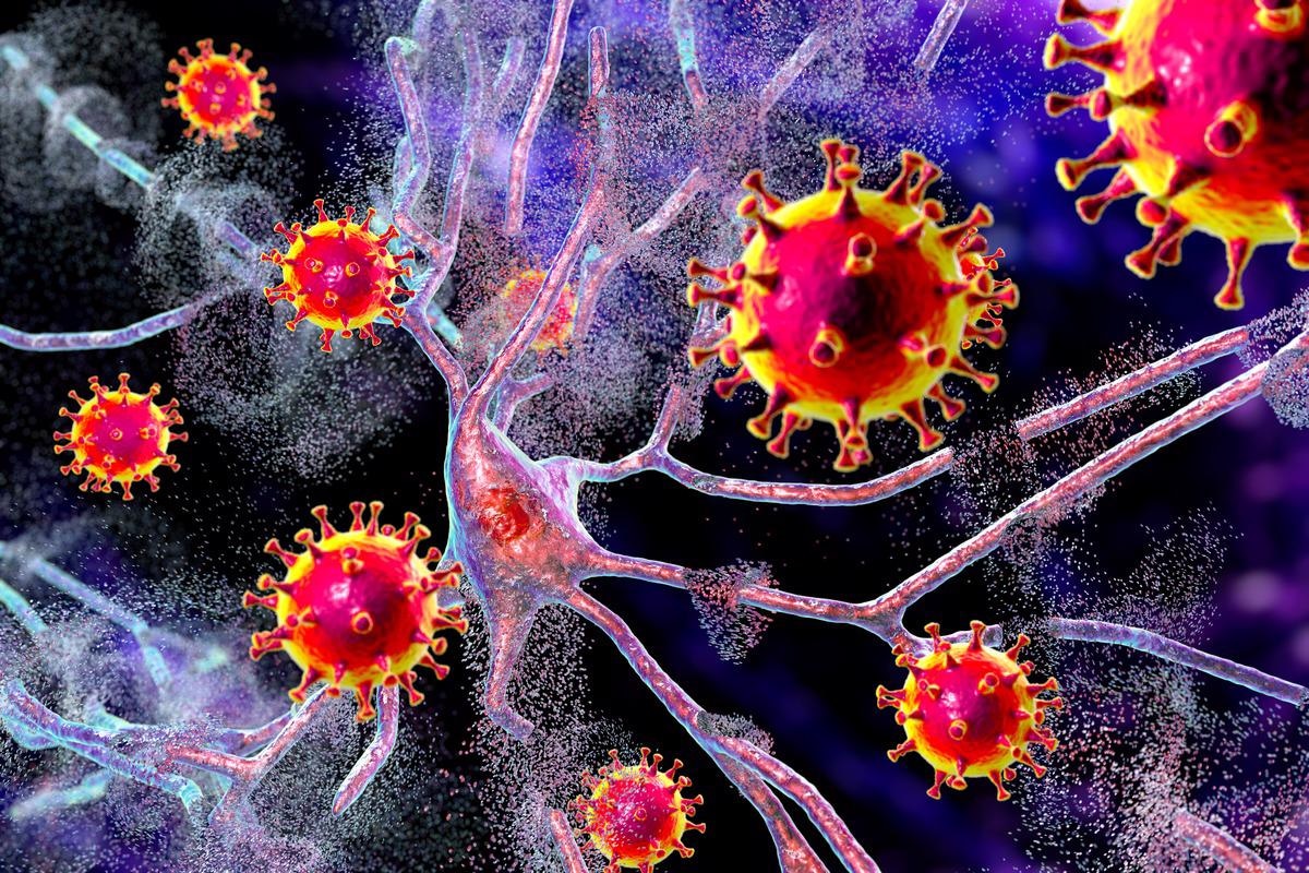 Study: SARS-CoV-2 impairs the disassembly of stress granules and promotes ALS-associated amyloid aggregation. Image Credit: Kateryna Kon / Shutterstock.com