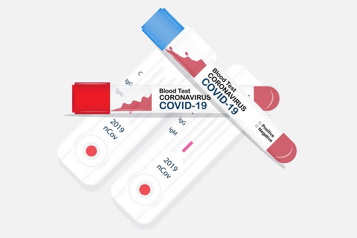 Study: T-cell Receptor Sequencing Identifies Prior SARS-Cov-2 Infection And Correlates with Neutralizing Antibodies And Disease Severity. Image Credit: Panggabean / Shutterstock.com
