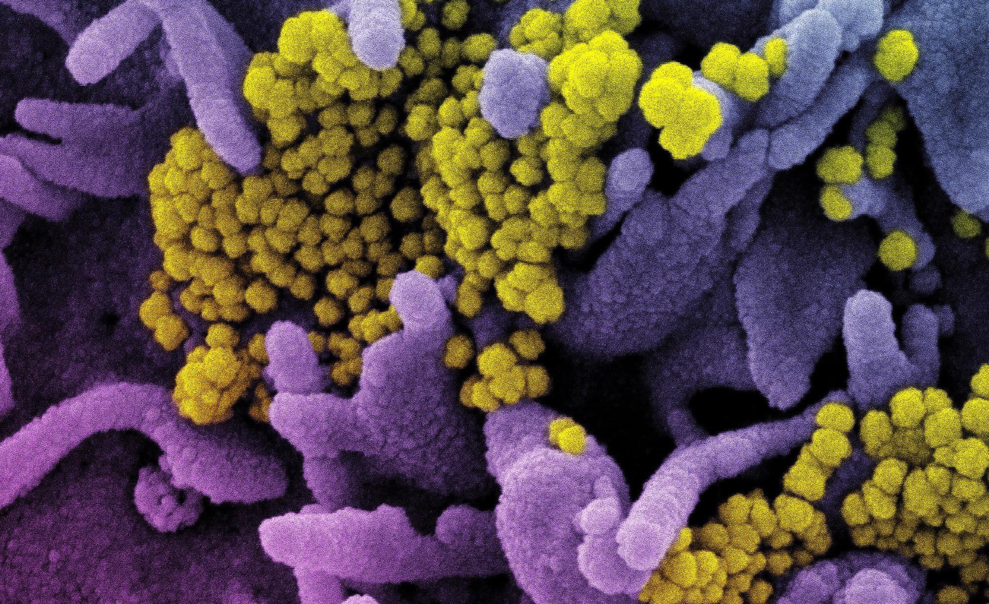 Study: Omicron infection enhances Delta antibody immunity in vaccinated persons. Image Credit: NIAID