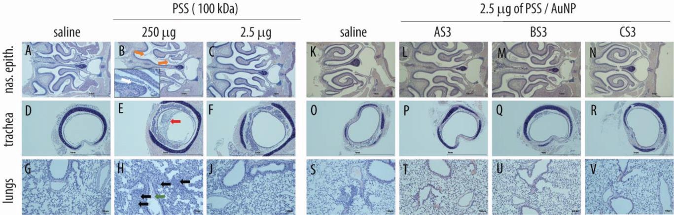Histopathological evaluation in respiratory organs following administration of PSS (A–J) and core–shell PSS-AuNP nanoformulations (K–V). Images depict nasal epithelium (A–C; K–N), trachea (D–F; O–R), and lung tissue (G–J; S–V) for vehicle controls (saline, panels A, D, G, K, O, S), 100 kDa PSS dosed at 250 µg (highest feasible dose, HFD, panels B, E, H) or 2.5 µg (highest tolerable dose, panels C, F, J); AS3 (L, P, T); BS3 (M, Q, U) and CS3 (N, R, V) dosed at 2.5 µg. For PSS and core–shell nanoformulations dosed at 2.5 µg, no histopathological changes, as compared to vehicle, were evident.