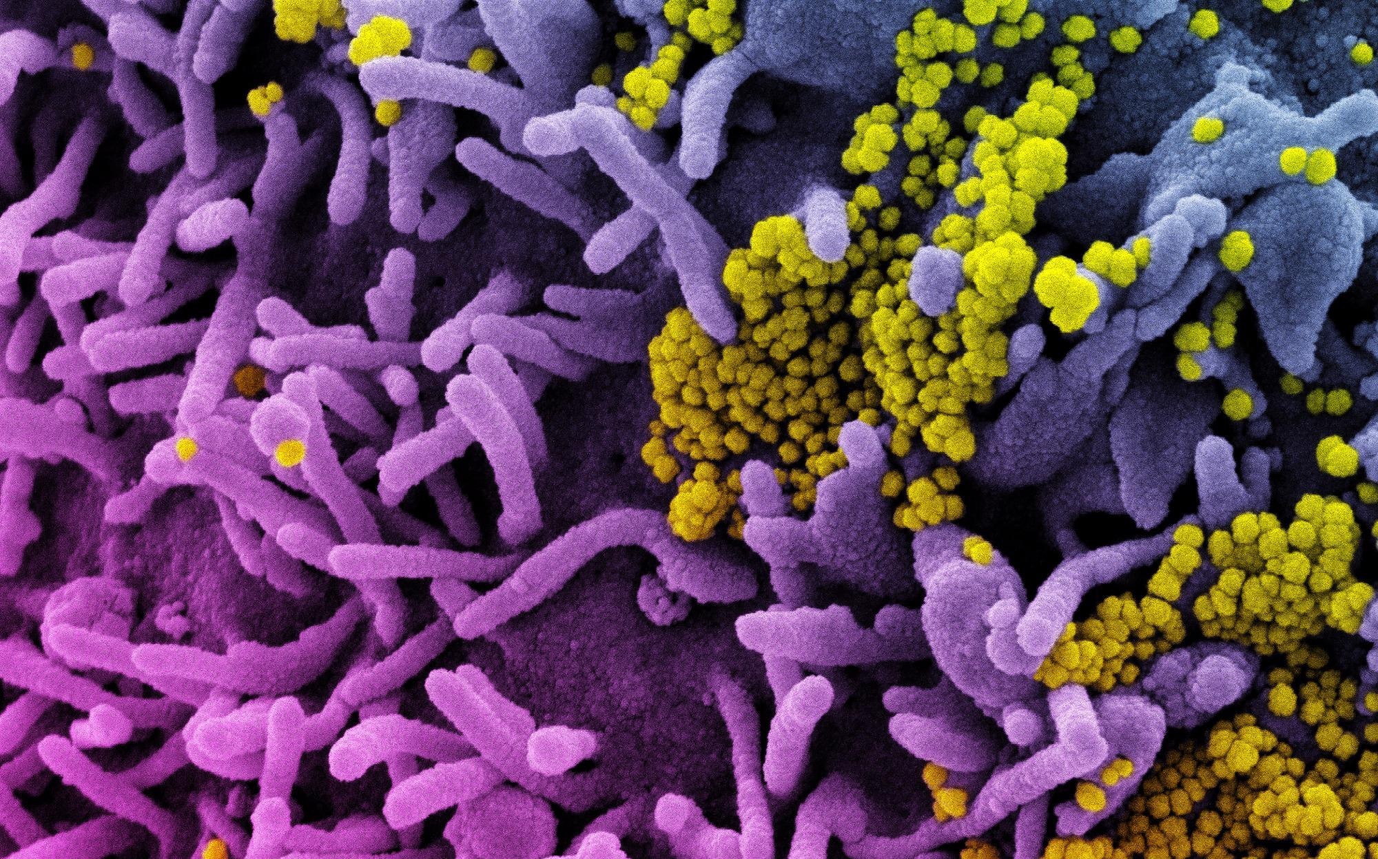 Study: The unique ORF8 protein from SARS-CoV-2 binds to human dendritic cells and induces a hyper-inflammatory cytokine storm. Image Credit: NIAID