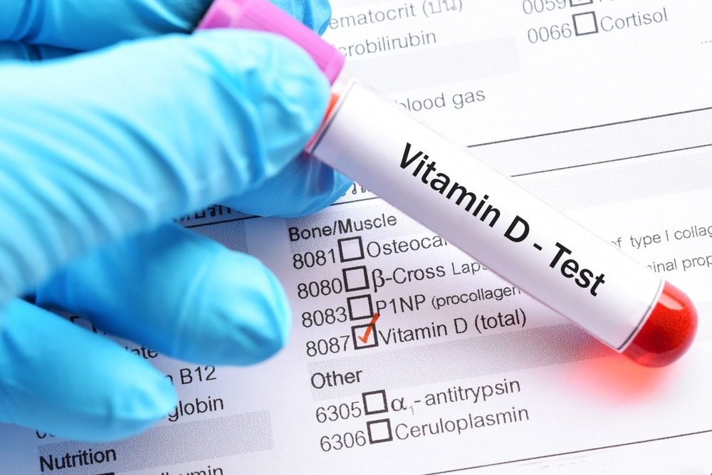 Study: COVID-19 and Osteoporosis: Shared Mechanisms and Crosstalk via Vitamin D. Image Credit: Jarun Ontakrai / Shutterstock.com