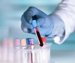 Final results of the PATHFINDER study by GRAIL on multi-cancer early detection tests announced