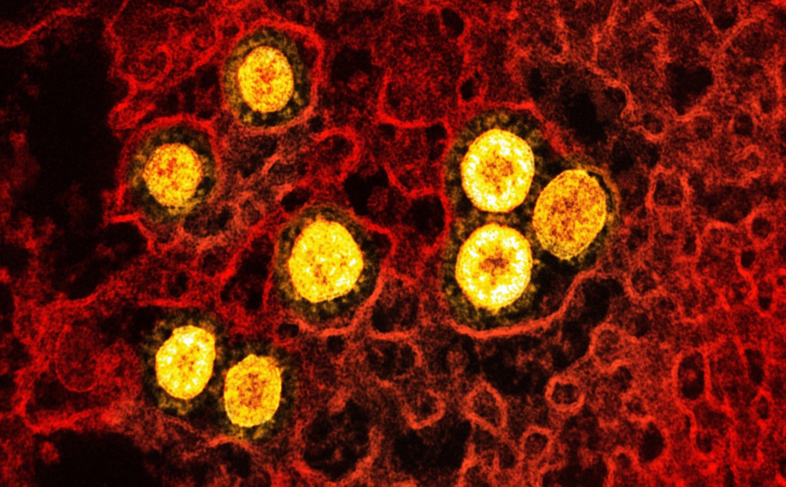 Study: Bivalent SARS-CoV-2 mRNA vaccines increase breadth of neutralization and protect against the BA.5 Omicron variant. Image Credit: NIAID