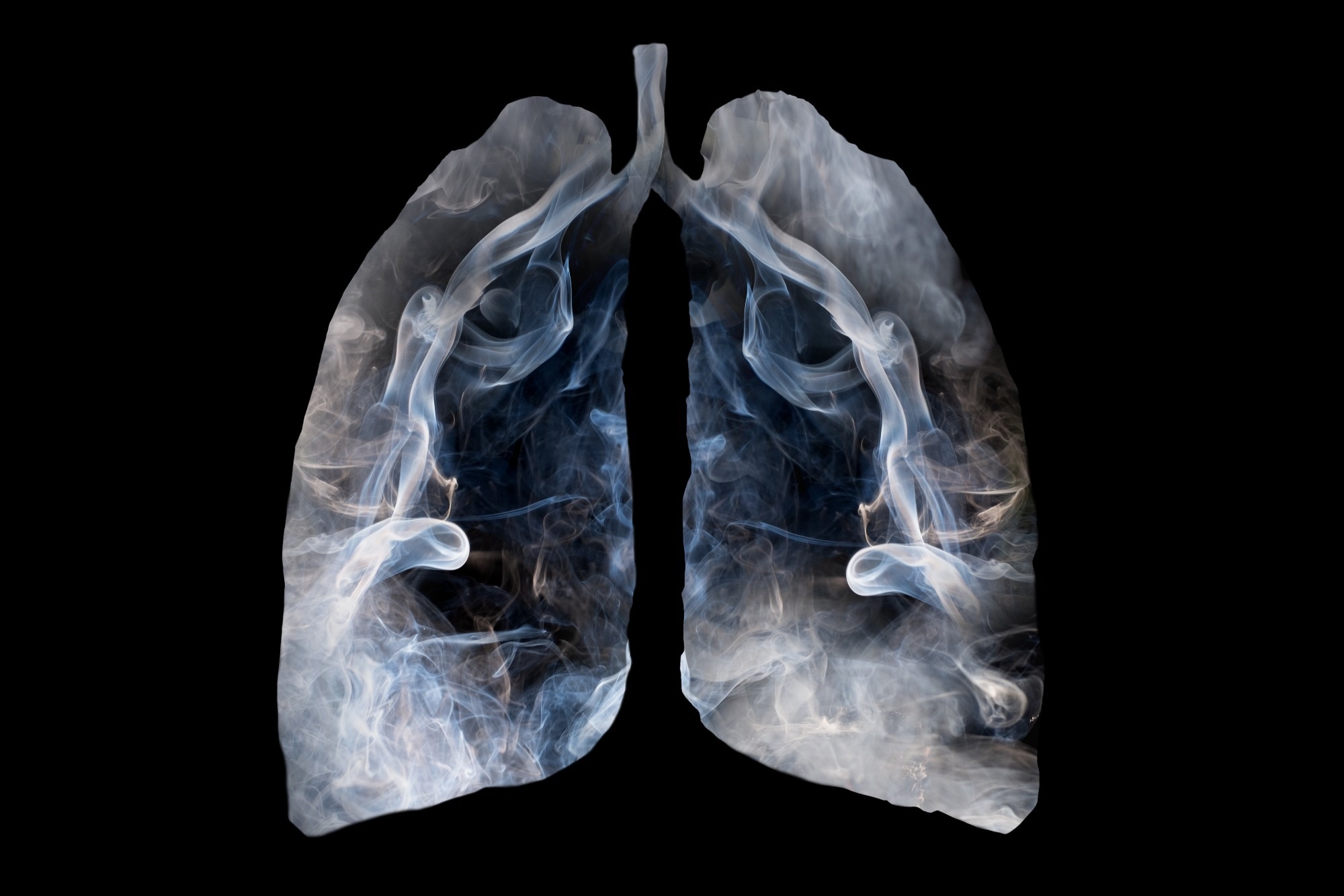 Study: Spike mutation resilient scFv76 antibody counteracts SARS-CoV-2 lung damage upon aerosol delivery. Image Credit: Thichaa/Shutterstock