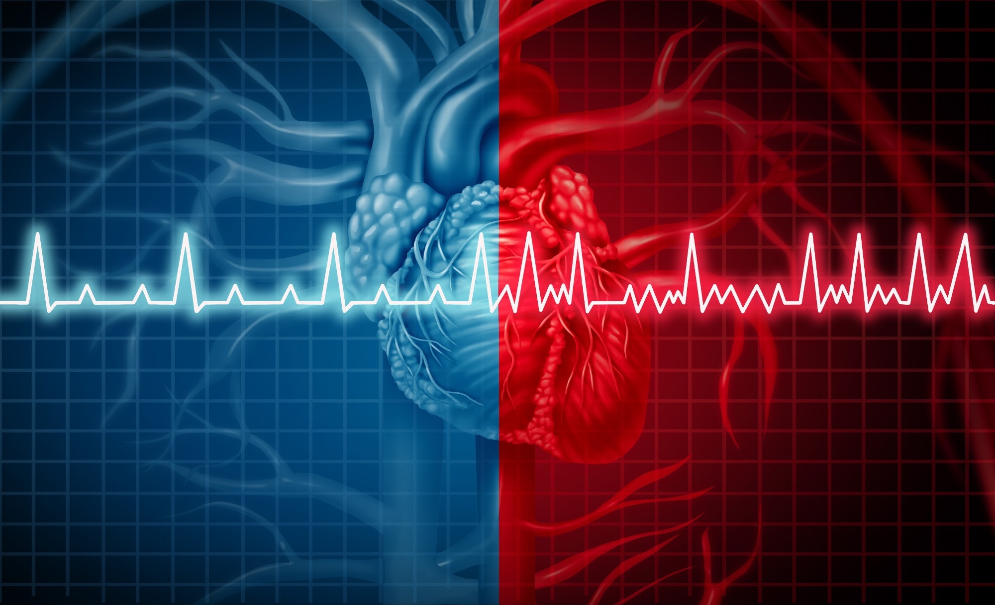 Original Investigation: Polygenic Risk Score Predicts Sudden Death in Patients With Coronary Disease and Preserved Systolic Function. Image Credit: Lightspring / Shutterstock