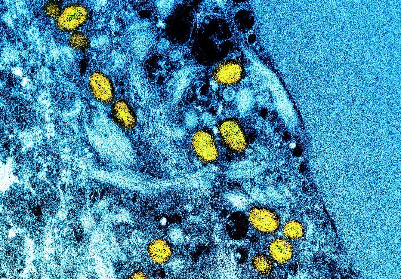 Study: Evaluating the accuracy of self-collected swabs for the diagnosis of monkeypox. Image Credit: NIAID