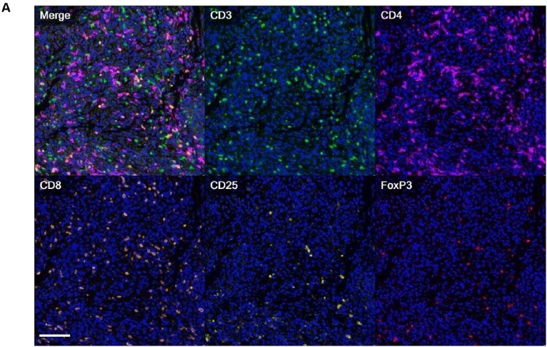 Detecting tissue-resident memory T cells in solid tumors