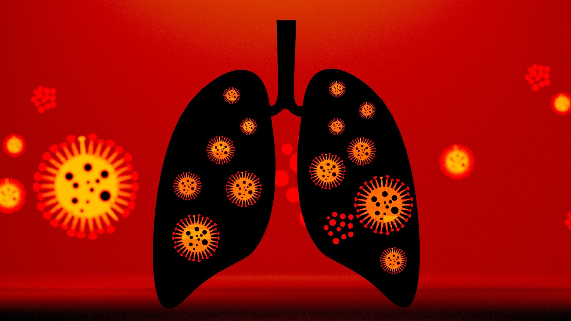 Study: The 2022 RSV surge was driven by multiple viral lineages. Image Credit: B-th / Shutterstock