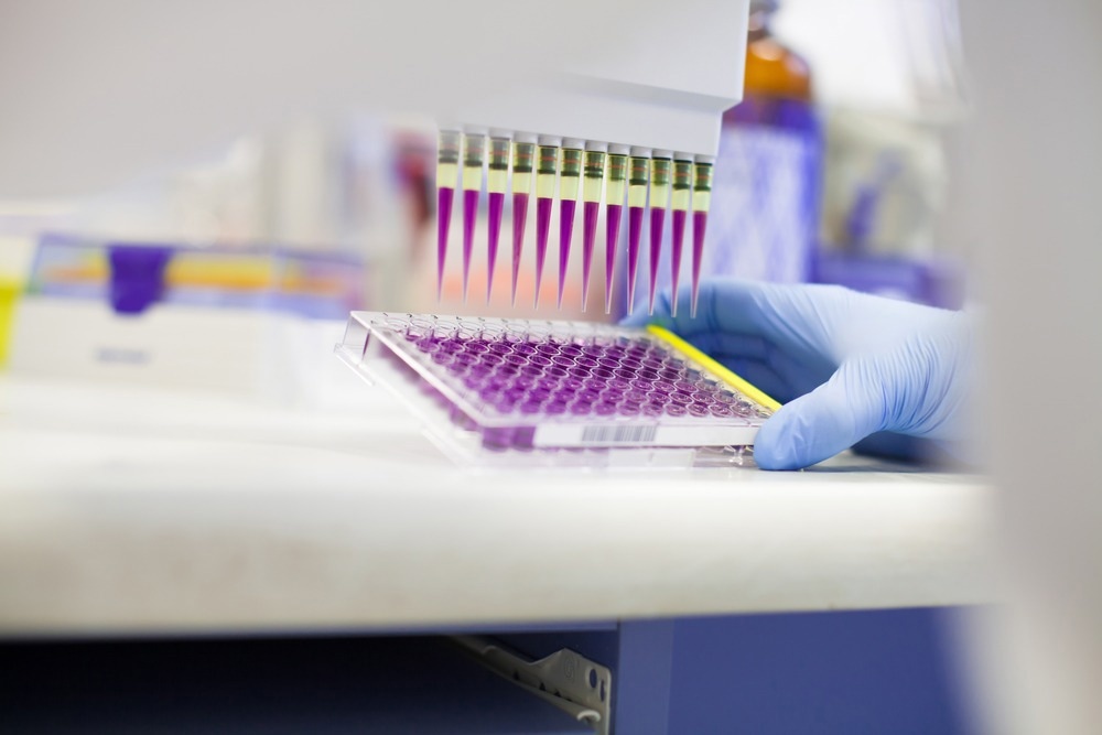 Study: Mpox infection investigation using multiplexed syndromic diagnostics: Evaluation of an AusDiagnostics multiplexed tandem PCR (MT-PCR) syndromic panel. Image Credit: PolakPhoto / Shutterstock.com
