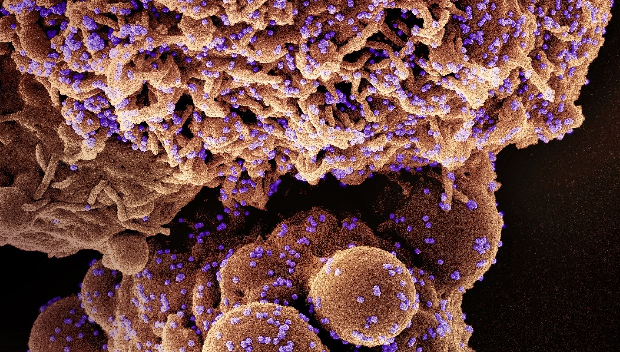 Study: Hospital Outcomes of Community-Acquired SARS-CoV-2 Omicron Variant Infection Compared With Influenza Infection in Switzerland. Image Credit: NIAID