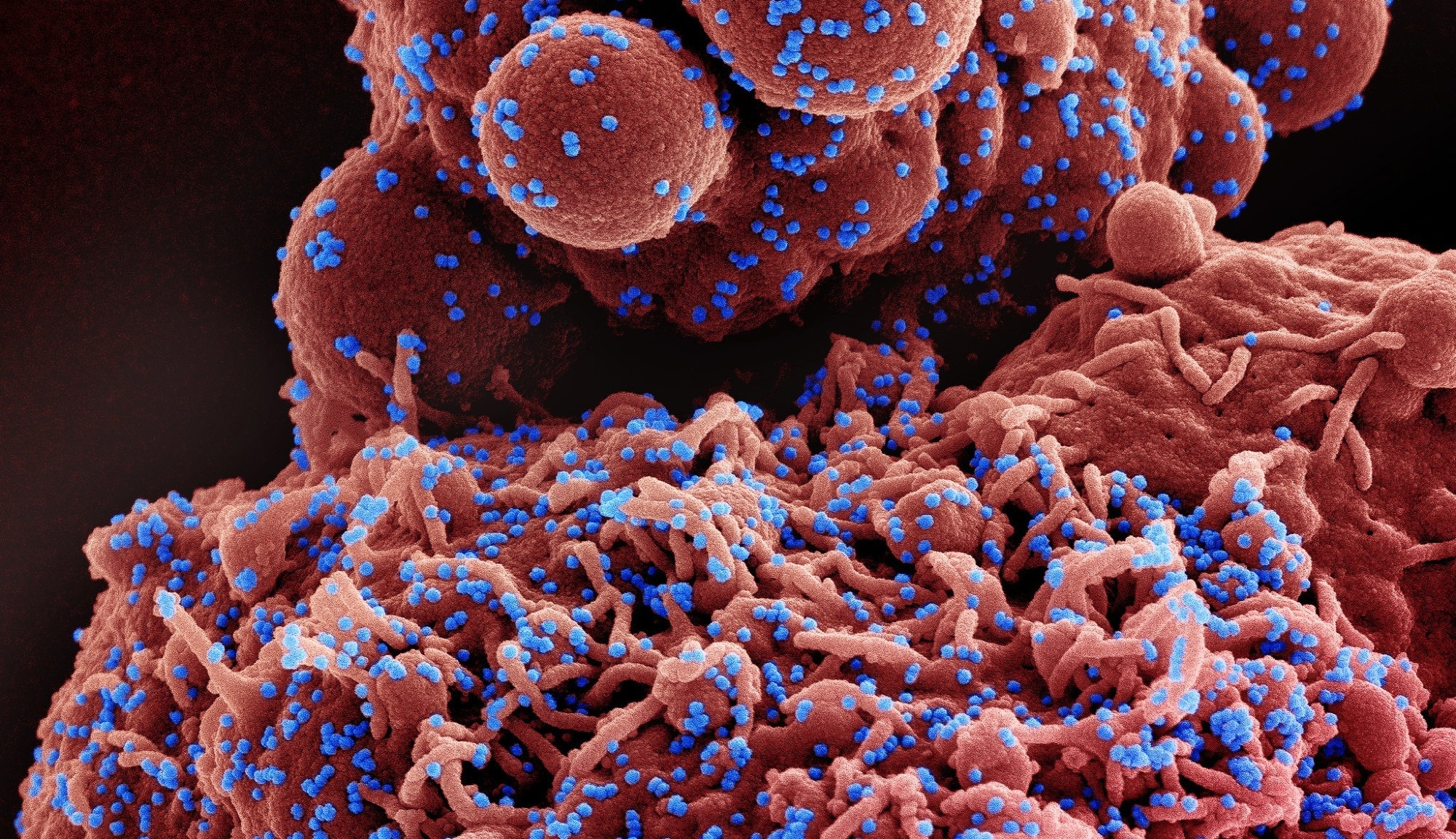 Study: Higher risk of SARS-CoV-2 Omicron BA.4/5 infection than of BA.2 infection after previous BA.1 infection, the Netherlands, 2 May to 24 July 2022. Image Credit: NIAID