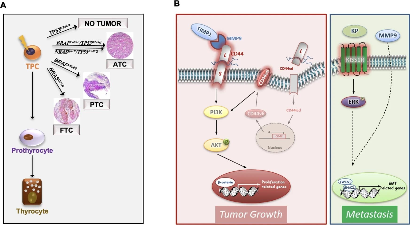 A Schematic model illustrating that the most common TC genetic alterations (BRAFV600E, NRASQ61R, BRAFV600E/TP53R248Q and NRASQ61R/TP53R248Q) in thyroid progenitor cell (TPC) recapitulate the different TC histotypes (FTC, PTC and ATC). Of note TP53R248Q alone is not required for TC initiation. B Model of ternary complex (TIMP1/MMP9/CD44) and KISS1R driven pathways in engineered D22 TPCs. TIMP1 and pro-MMP9 complex formation activates MMP9 and consequently leads to the cleavage of CD44. The CD44 intracytoplasmic domain (CD44icd) translocates into the nucleus where it induces CD44v6 transcription. CD44v6 promotes TPC proliferation through PI3K/AKT pathway. The binding of kisspeptins (KP) to KISS1R activates ERK and cooperates with MMP9 to promote the transcription of EMT-related genes, including TWIST and SNAIL, driving metastatic engraftment.