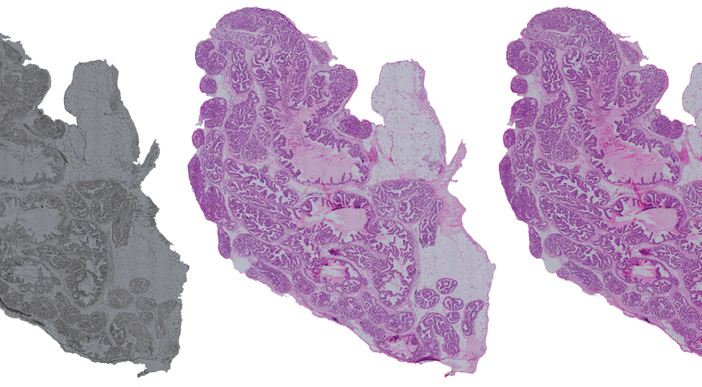 New AI-based method for virtual staining of histopathological tissue samples