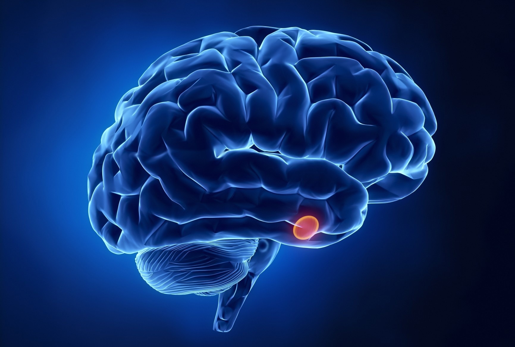 Medical management of pituitary apoplexy yields similar results to surgery, finds study