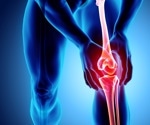 Injectable fatty acid copolymer ARA 3000 BETA shows therapeutic potential in treating osteoarthritis