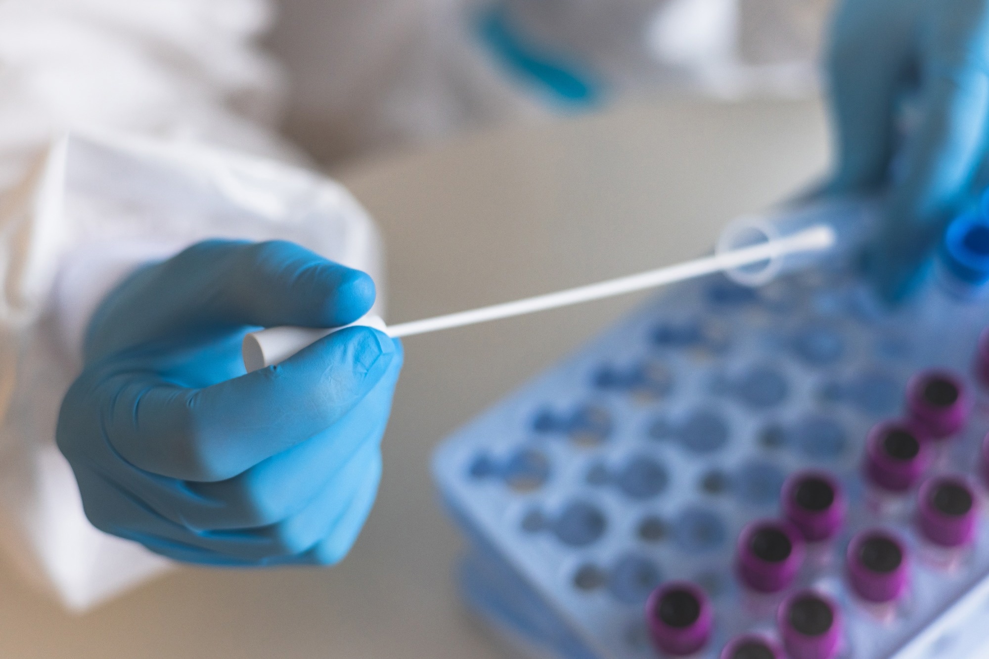 Study: The Defenders of the Alveolus Succumb in COVID-19 Pneumonia to SARS-CoV-2 and Necroptosis, Pyroptosis, and PANoptosis. Image Credit: Tsuguliev/Shutterstock.com