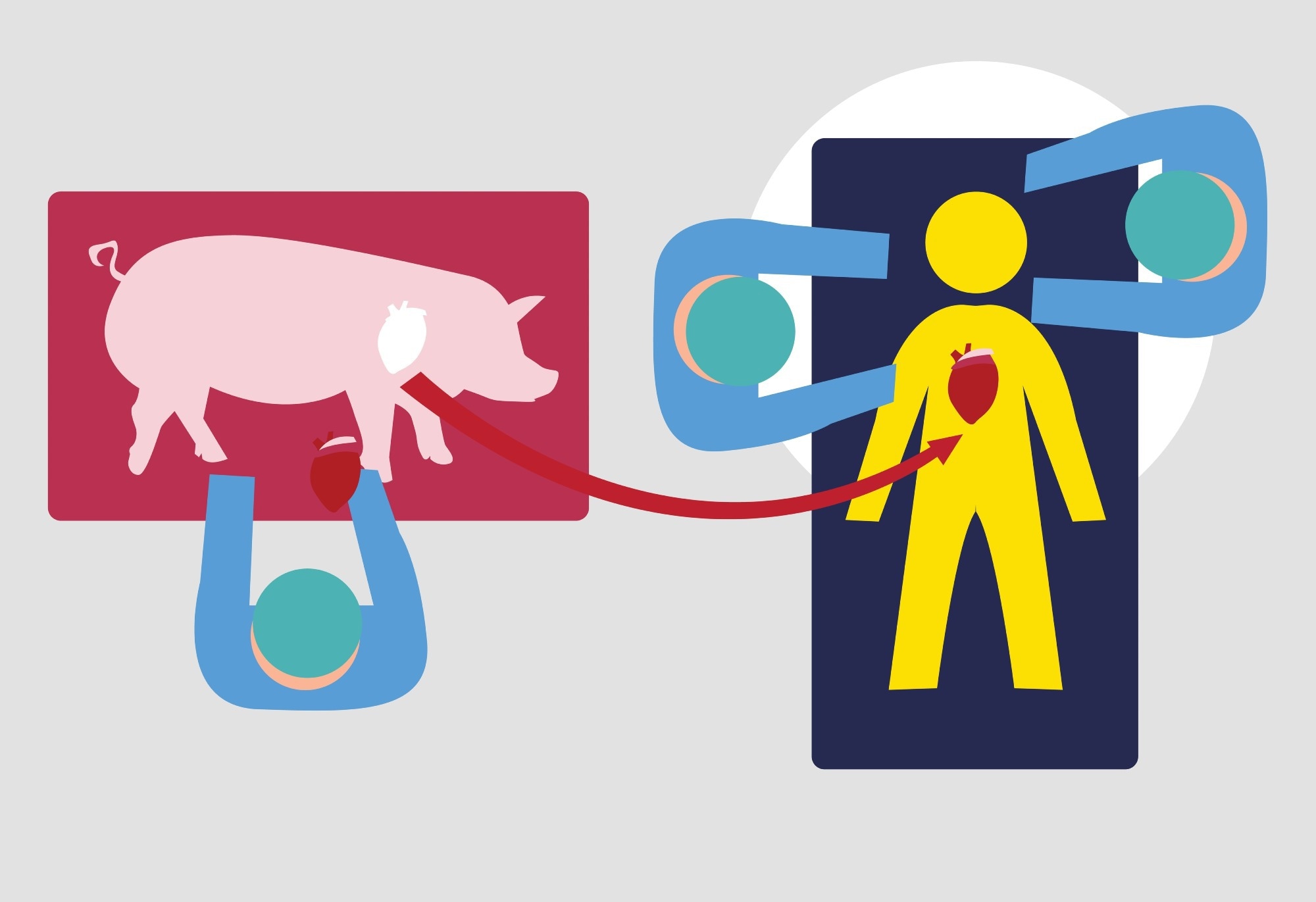 Study: Graft dysfunction in compassionate use of genetically engineered pig-to-human cardiac xenotransplantation: a case report. Image Credit: CrystalEyeStudio/Shutterstock.com