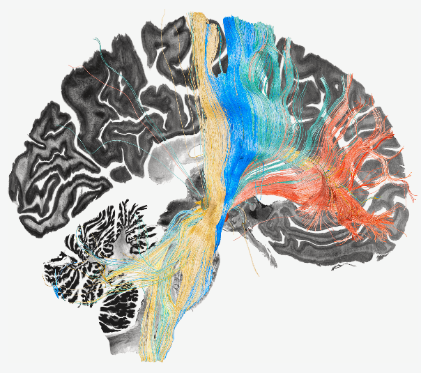 Using deep brain stimulation to map dysfunctional brain circuits linked to four disorders