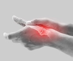 New research finds no causal link between vitamin E levels and osteoarthritis