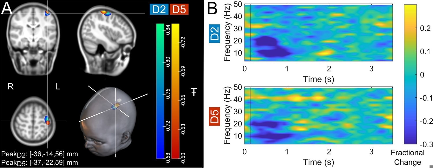 Data from a single participant (7 years of age). (A) Brain plots show slices through the left motor cortex, with a pseudo-T-statistical map of beta modulation. The blue/green peaks indicate locations of largest beta modulation during stimulation for index finger trials (digit 2/D2), while the red/yellow peaks show the little finger (digit 5/D5). (B) Time-frequency spectra showing neural oscillatory amplitude modulation (fractional change in spectral amplitude relative to baseline measured in the 2.5–3 s window) for both fingers, using data extracted from the location of peak beta modulation (left sensorimotor cortex). Vertical lines indicate the time of the first braille stimulus. Note the beta amplitude reduction during stimulation, as expected.