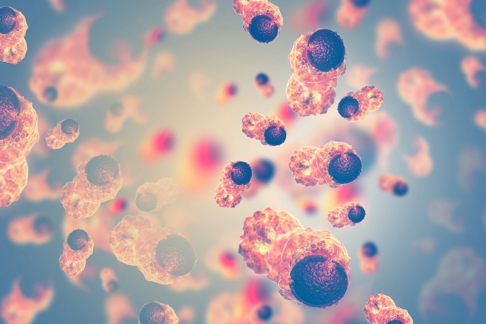 Image Credit: crystal light/Shutterstock.com cancer cells, nanomedicine
