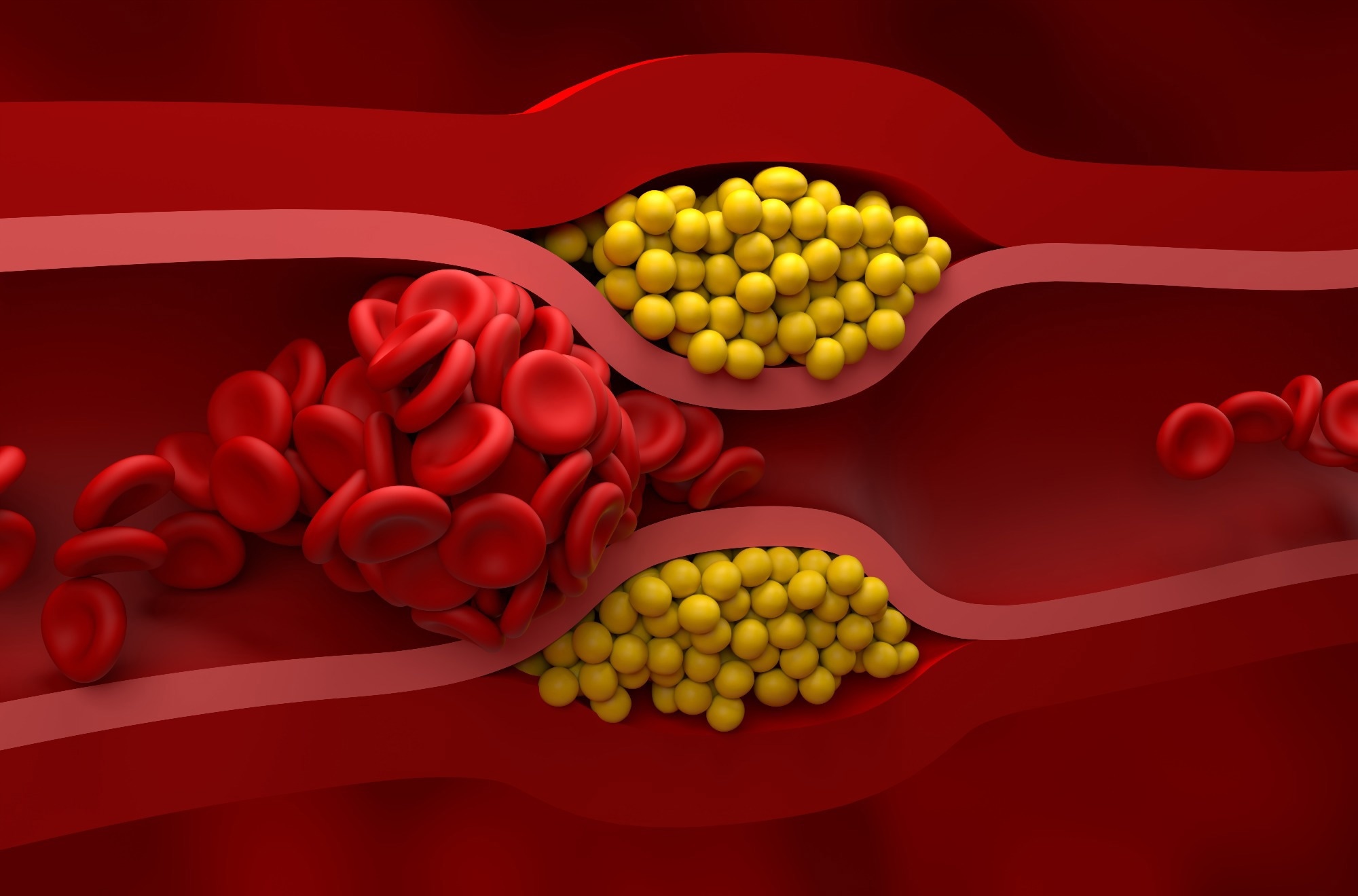 Study: Effects of lipoproteins on metabolic health. Image Credit: Nemes Laszlo / Shutterstock.com